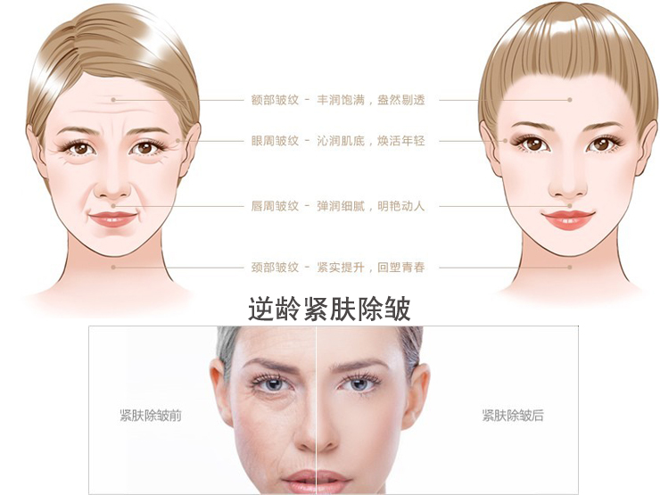 逆龄紧肤除皱