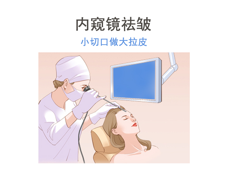 内窥镜祛皱（小切口面部提升）